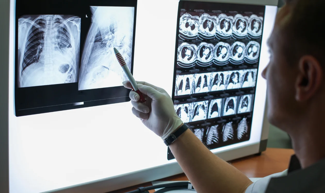 A healthcare professional looking at scans of lungs