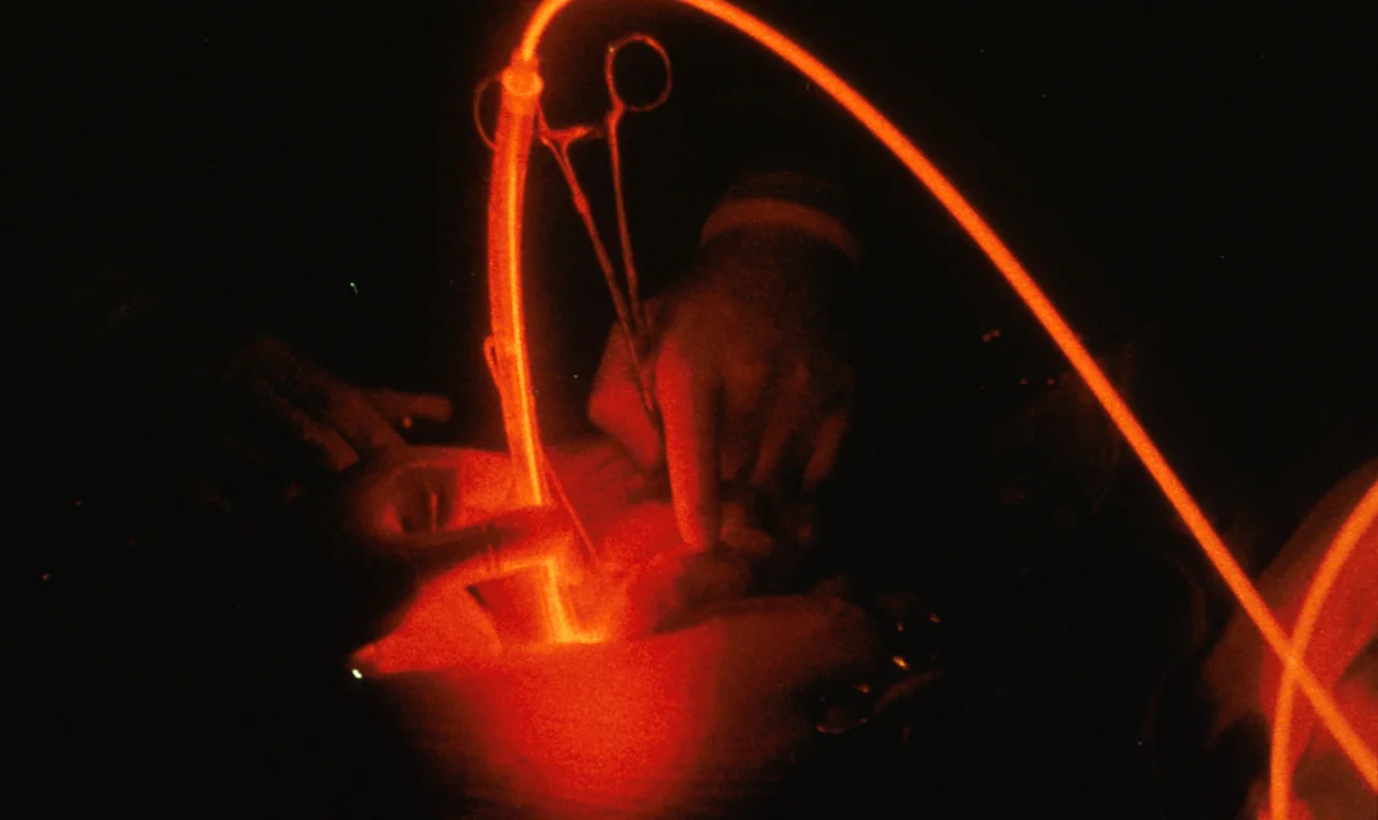 Close-up of hands holding a red-lit optical fibre and surgical scissors